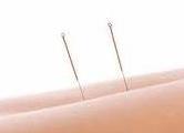 Image of Acupuncture Needles